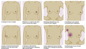 What to look out for (Image courtesy of Breast Cancer Care)